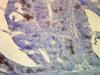 HSP70/HSC70 Antibody (RPE)