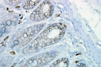 HSP90 Antibody: Biotin