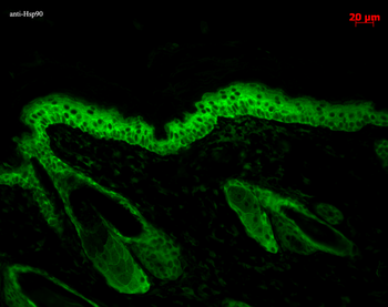 HSP90 Antibody: Biotin