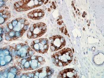 HSP90 Antibody: HRP
