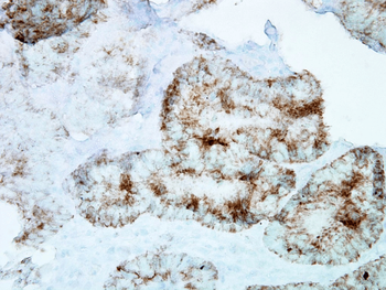 HSP60 Antibody: Biotin