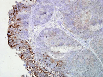 HSP90 Antibody: Biotin
