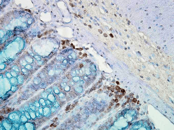 HSP90 Antibody: Biotin