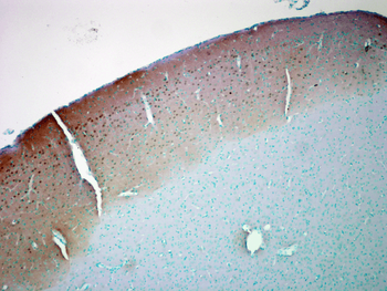 CaMKII (Alpha-Specific) Antibody: FITC