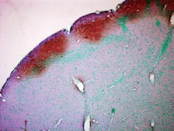 CaMKII Antibody: HRP