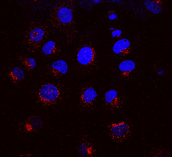KDEL Receptor Antibody (HRP)