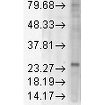 KDEL Receptor Antibody (RPE)