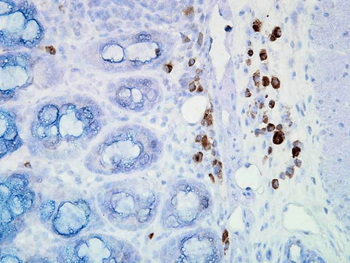 HSP90 Antibody (HRP)