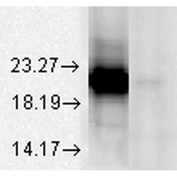 Alpha A Crystallin Antibody: RPE