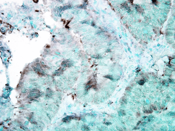 HSP90 (total) Antibody: FITC