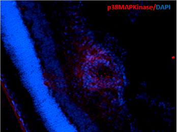 p38 MAPK Antibody (RPE)
