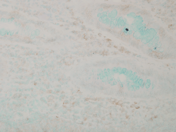 p38 MAPK Antibody (RPE)