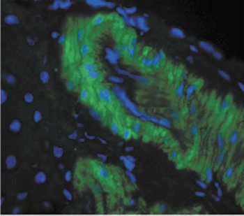 Nitrotyrosine Antibody: APC