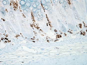 Nitrotyrosine Antibody: PerCP
