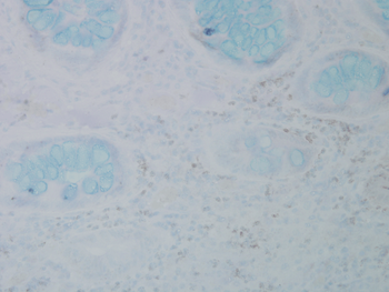 Nitrotyrosine Antibody: PerCP