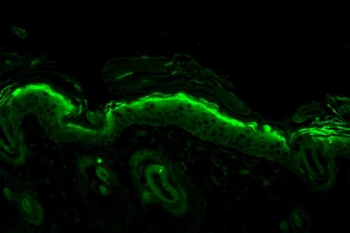Nitrotyrosine Antibody: PerCP