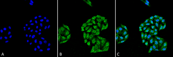 HSP70 Antibody (RPE)
