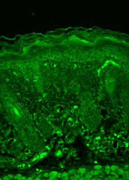 Rhodopsin Antibody (APC)