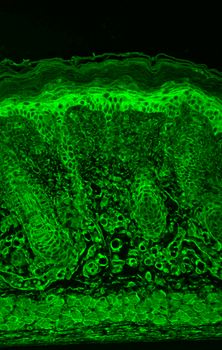 HIF 1 alpha Antibody (APC)