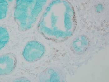 DNMT1 Antibody (RPE)