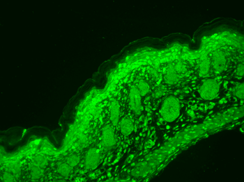Cav1.3 Antibody: APC
