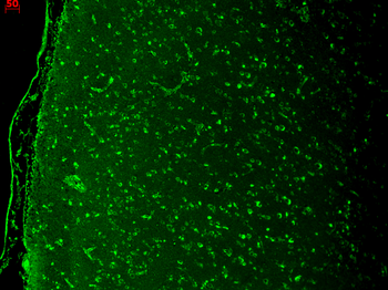 Cav1.3 Antibody: APC