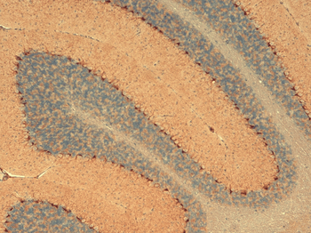 HCN1 Antibody: Biotin