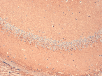 HCN1 Antibody: FITC