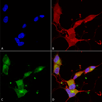 KCNQ4 Antibody: RPE