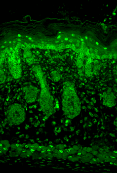 Kir2.1 Antibody: HRP