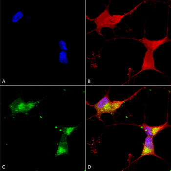 Kir2.1 Antibody: RPE