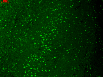 Kir2.1 Antibody: RPE