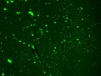 Nav1.7 Antibody: FITC