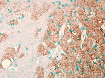 Nav1.7 Antibody: HRP