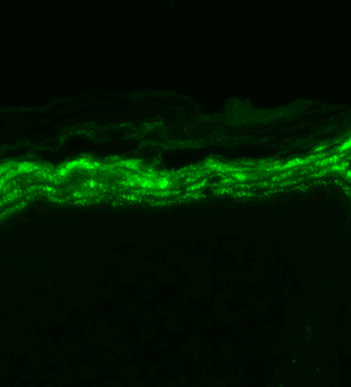 Nav1.7 Antibody: HRP