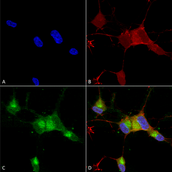 Nav1.7 Antibody: RPE