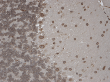 TrpM7 Antibody: APC