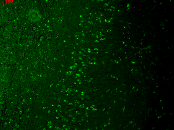 TrpM7 Antibody: APC