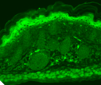 TrpV3 Antibody: FITC