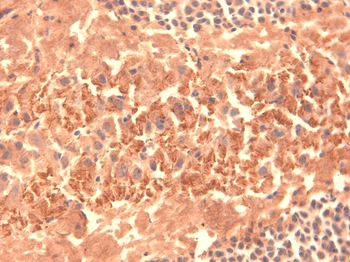 HCN4 Antibody: RPE