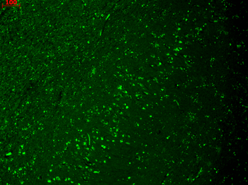 HCN4 Antibody: RPE
