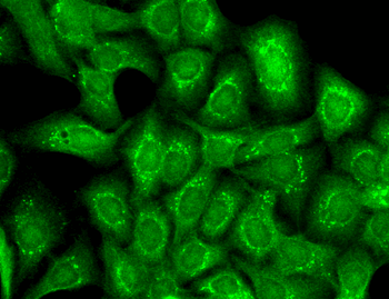 Slo2.2 Antibody: PerCP