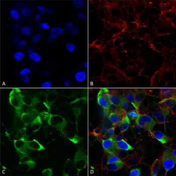 Slo2.2 Antibody: RPE