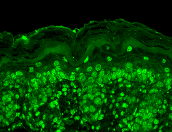 CavBeta2 Antibody (APC)