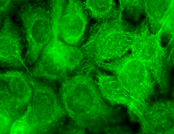 TRPV3 Antibody (APC)