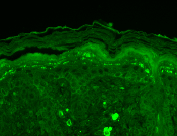 SHANK3 Antibody: RPE