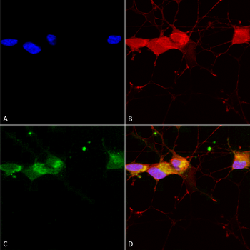 NR2B Antibody (Biotin)