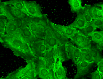 NR2B Antibody (HRP)