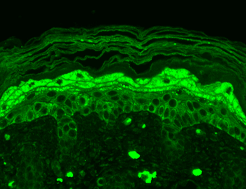 NR2B Antibody (RPE)