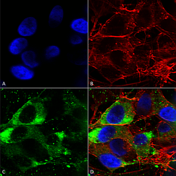 Nav1.8 Antibody (HRP)